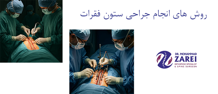 روش های انجام جراحی ستون فقرات
