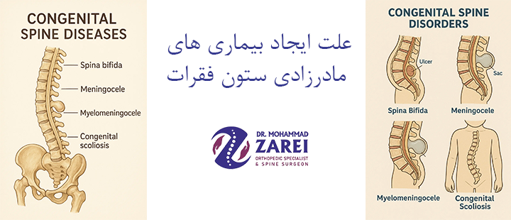 علت ایجاد بیماری های مادرزادی ستون فقرات