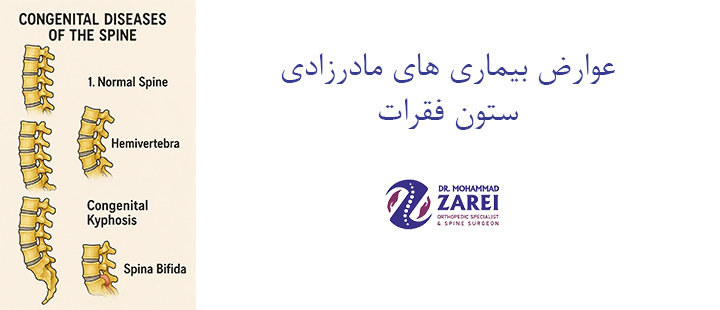 عوارض بیماری های مادرزادی ستون فقرات