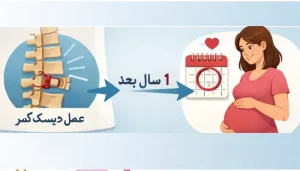بهترین زمان حاملگی بعد از جراحی دیسک کمر چه زمانی است؟