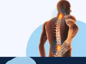 بیرون زدگی دیسک کمر چیست؟