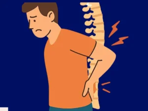 مهم ترین علائم دیسک کمر خفیف+ روش تشخیص و درمان
